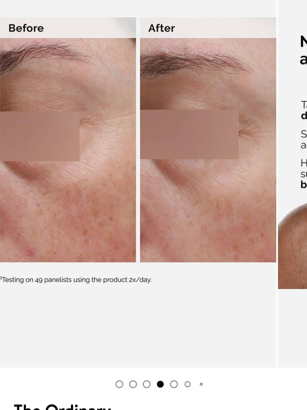 The Ordinary ordinary niacinamide